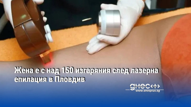 Жена е с над 150 изгаряния след лазерна епилация в Пловдив