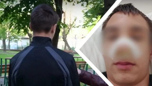 13-годишен ученик е със счупен нос и комоцио след побой в Русе