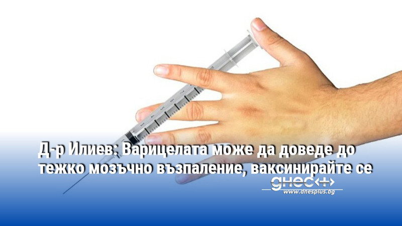 Д-р Илиев: Варицелата може да доведе до тежко мозъчно възпаление, ваксинирайте се