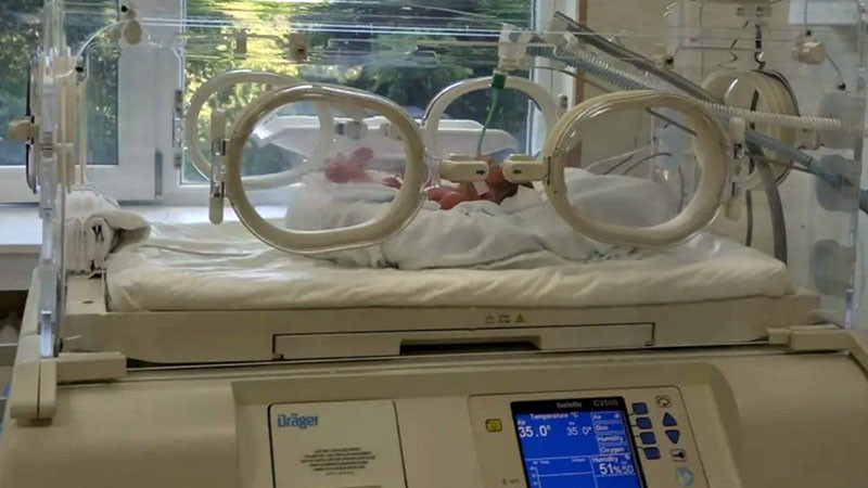 Неонатолози в Пловдив се борят за живота на 980-грамово момченце