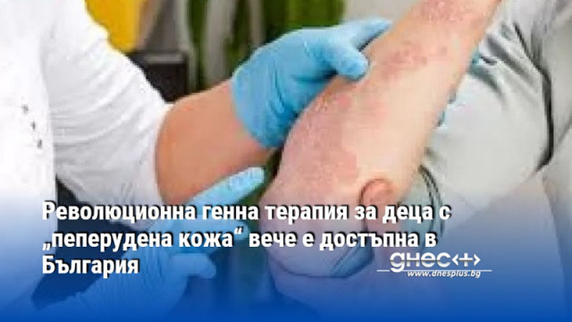 Революционна генна терапия за деца с „пеперудена кожа“ вече е достъпна в България