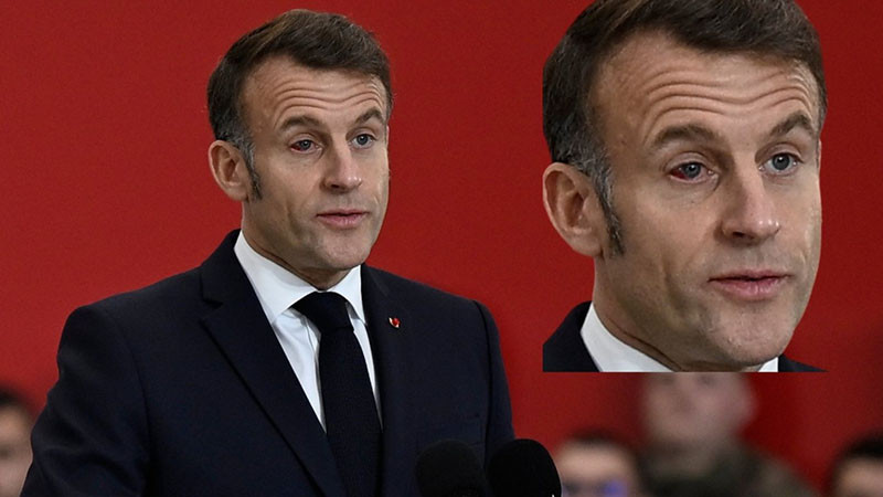 Макрон се появи с кръвоизлив в окото пред френски военни (видео)