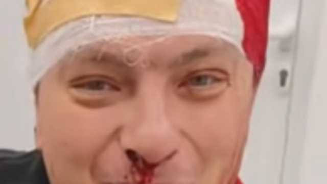 Брутален побой разтърси Гоце Делчев   Общинският координатор на партия