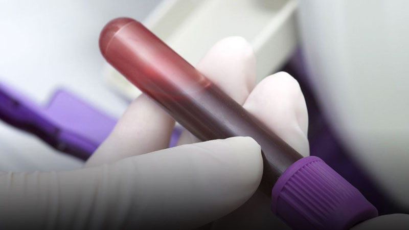 Кръвната проба на шефа на парк "Рила" показа близо 3 промила