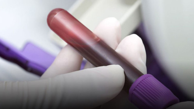 Кръвната проба на шефа на парк "Рила" показа близо 3 промила