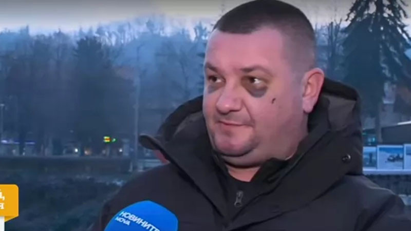 Завързан с белезници и ритан в главата: Мъж твърди, че е жестоко пребит в дискотека в Троян