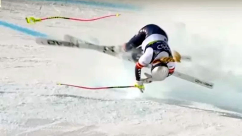 Линдзи Вон е със счупен крак в интензивно отделение