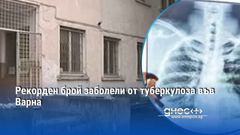 Рекорден брой заболели от туберкулоза във Варна