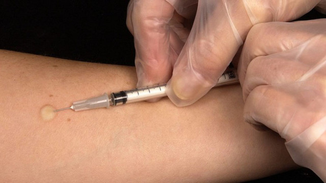 РЗИ-Варна призовава за ваксинация срещу менингококи