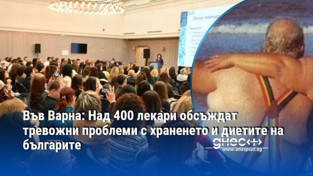 Във Варна: Над 400 лекари обсъждат тревожни проблеми с храненето и диетите на българите