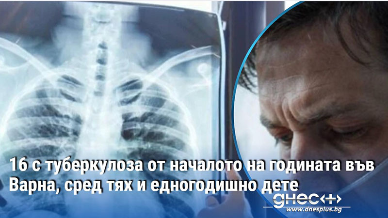 16 с туберкулоза от началото на годината във Варна, сред тях и едногодишно дете