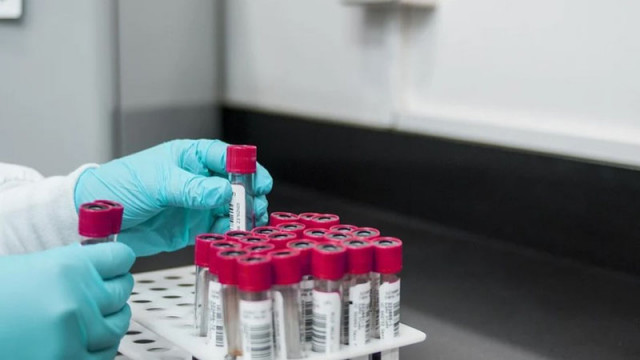 28 нови случая на морбили за седмица в област Враца