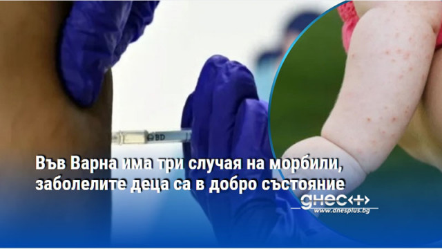 Във Варна има три случая на морбили, заболелите деца са в добро състояние