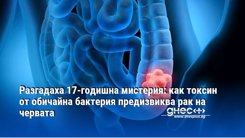 Разгадаха 17-годишна мистерия: как токсин от обичайна бактерия предизвиква рак на червата