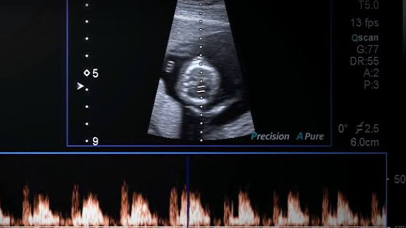 Разследват смъртта на две бебета във Варна
