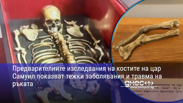 Предварителните изследвания на костите на цар Самуил показват тежки заболявания и травма на ръката