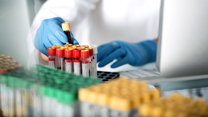 Рязък скок на случаите на COVID-19 в Бургас - 64 от общо 216 нови за страната