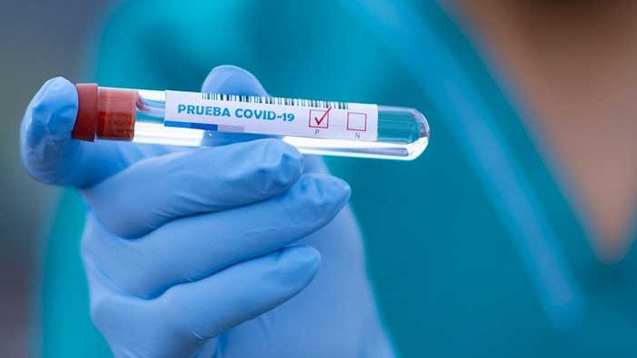 11 нови случая на COVID-19 в област Русе за изминалите 24 часа