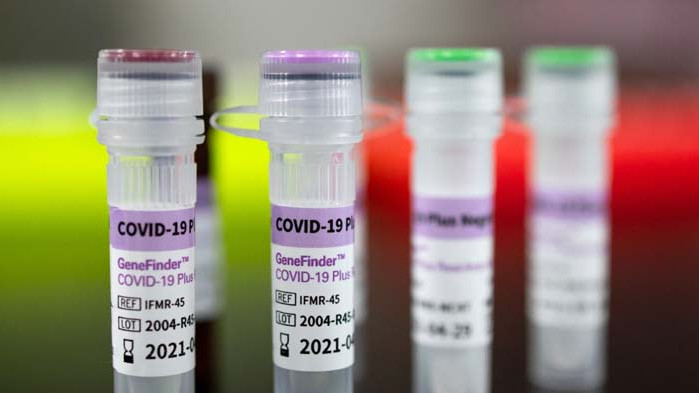 286 нови случая на COVID-19 у нас за последните 24 часа