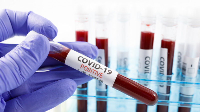 Шест са новите случаи на Covid-19 за денонощието във Варна