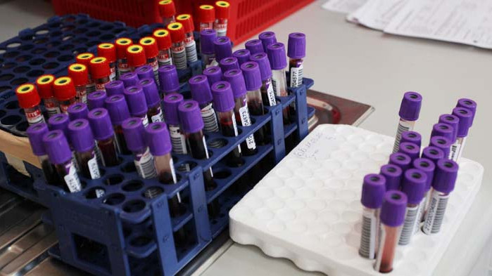 263 нови случая на COVID-19 у нас