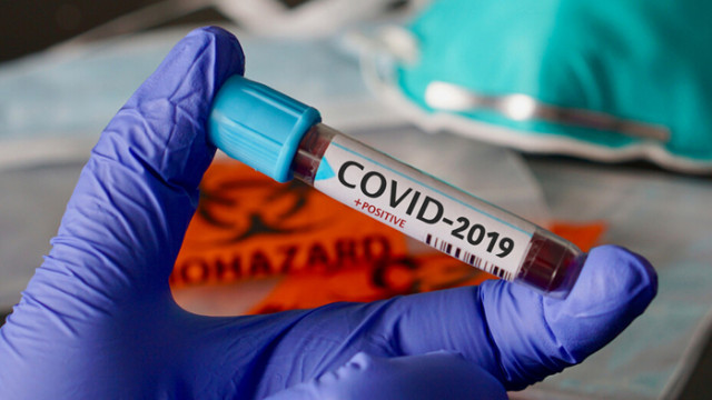 Един нов случай на COVID-19  в Русе за изминалите 24 часа