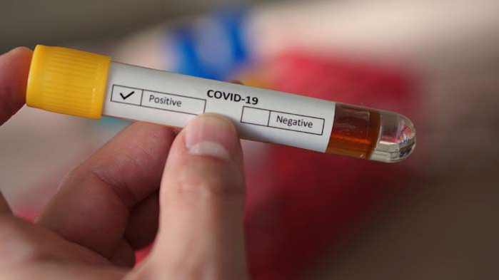 182 нови случая на COVID-19 у нас през последните 24 часа