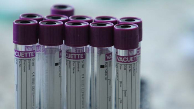 САЩ подписаха договор с AstraZeneca за доставка на лекарство срещу COVID-19