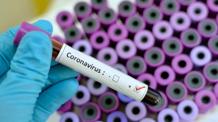 12 нови случая на COVID-19 в област Русе през изминалото денонощие