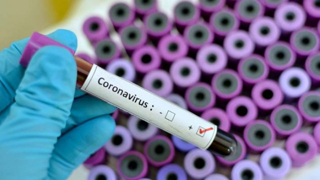 12 нови случая на COVID-19 в област Русе през изминалото денонощие