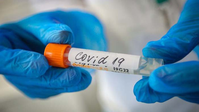 220 станаха активните случаи на covid-19 в област русе