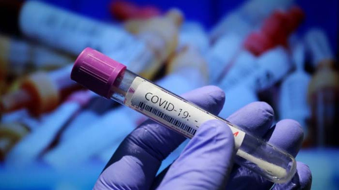 Част от оздравелите от коронавирус са останали без обоняние и вкусови рецептори