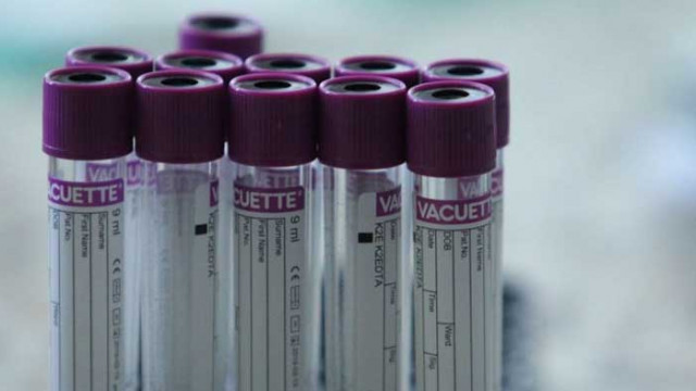 Инфаркт е причинил смъртта на мъжа, който не беше приет в болница със съмнения за COVID-19