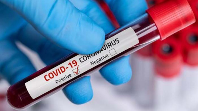 Нови рекорди: 2243 нови случая на COVID-19 и 42-ма починали за денонощието