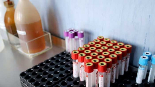 43 случая на COVID-19 в „Мини Марица-изток”