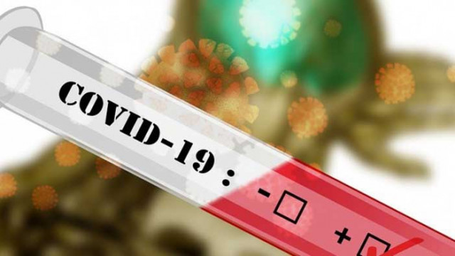 Украйна с рекорден прираст за денонощие на починали от коронавирус