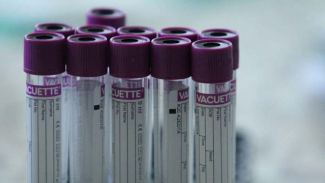 Малко статистика за сравнението между Covid-19 (а.к.а „грипчето“) и обикновения грип…