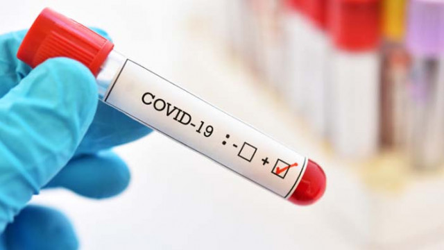 Кметът на Сливен е с COVID-19