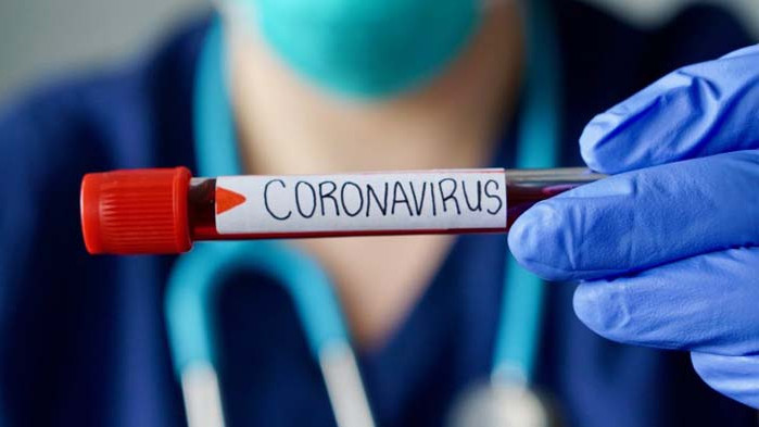 Рекордно високо ниво на починали от COVID-19 за ден в Иран