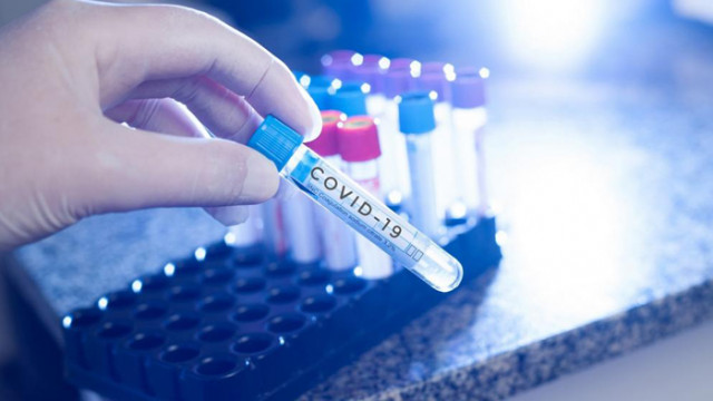 40 нови случая на covid-19 в област Русе  за изминалото денонощие