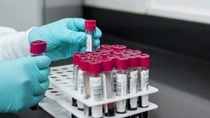 Седем учители в Стралджа са с положителни проби за COVID-19