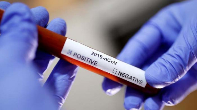 COVID-19 отне живота на 106 души през последното денонощие, нови 3816 са заразени