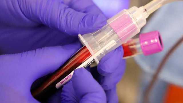 Кръвният център във Варна вече набира желаещи да дарят плазма