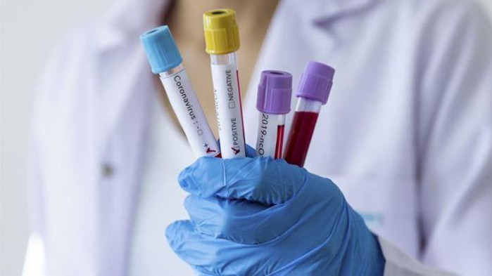 Над 1500 са активните случаи на COVID-19 в област Русе, 218 са новозаразените за денонощие