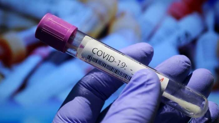 СЗО: За първи път от 3 месеца има спад на случаите на COVID-19 в Европа