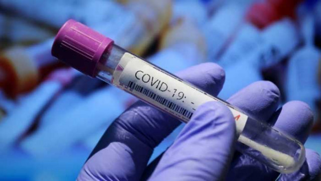 СЗО: За първи път от 3 месеца има спад на случаите на COVID-19 в Европа