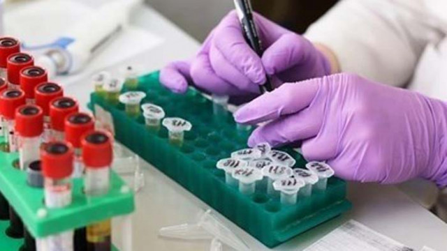 49 от 129 починали от COVID са без данни за стари заболявания