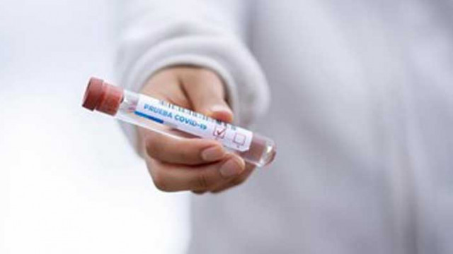 Рекорден брой смъртни случаи от COVID-19 в Сърбия