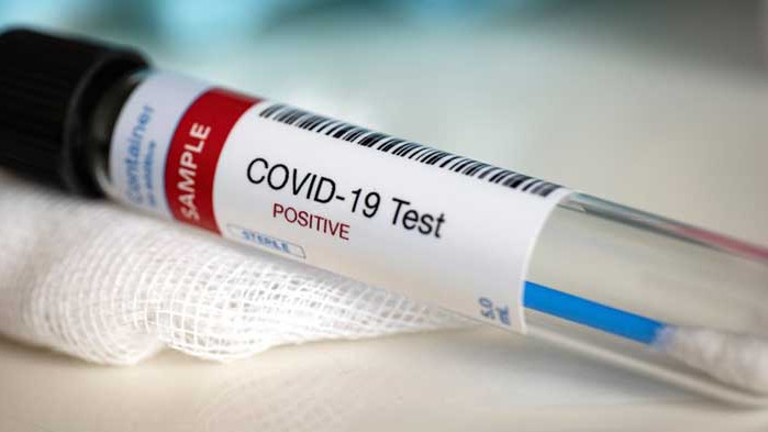 1729 са новите случаи на COVID-19 у нас в съботния ден