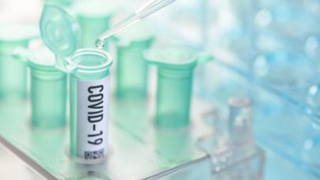 831 нови случая на COVID-19, 629 излекувани в област Русе през изминалата седмица